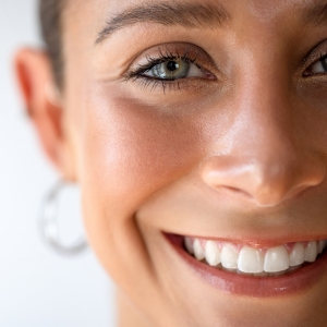 Laser CO2 frazionato