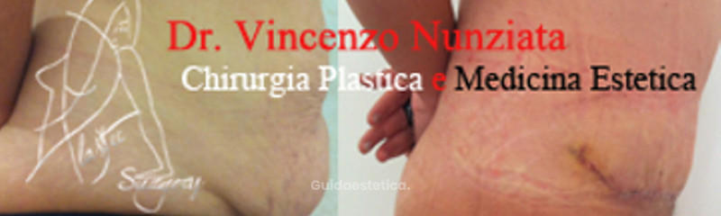 Bild zu Vincenzo Nunziata